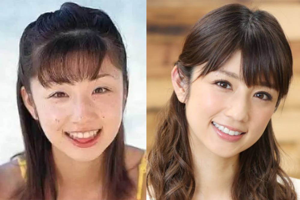 比較画像 小倉優子の顔が違う ほくろ除去で目は整形 卒アルと別人